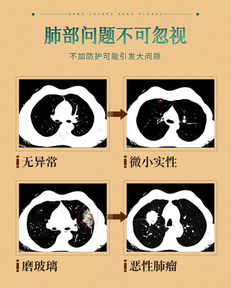 乐益宁3.jpg